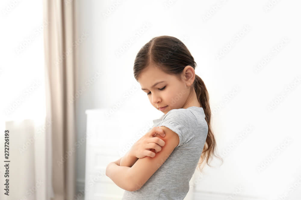 5 Surprising Questions About Baby Eczema Rash and How to Identify and Treat It 2 eczema rash