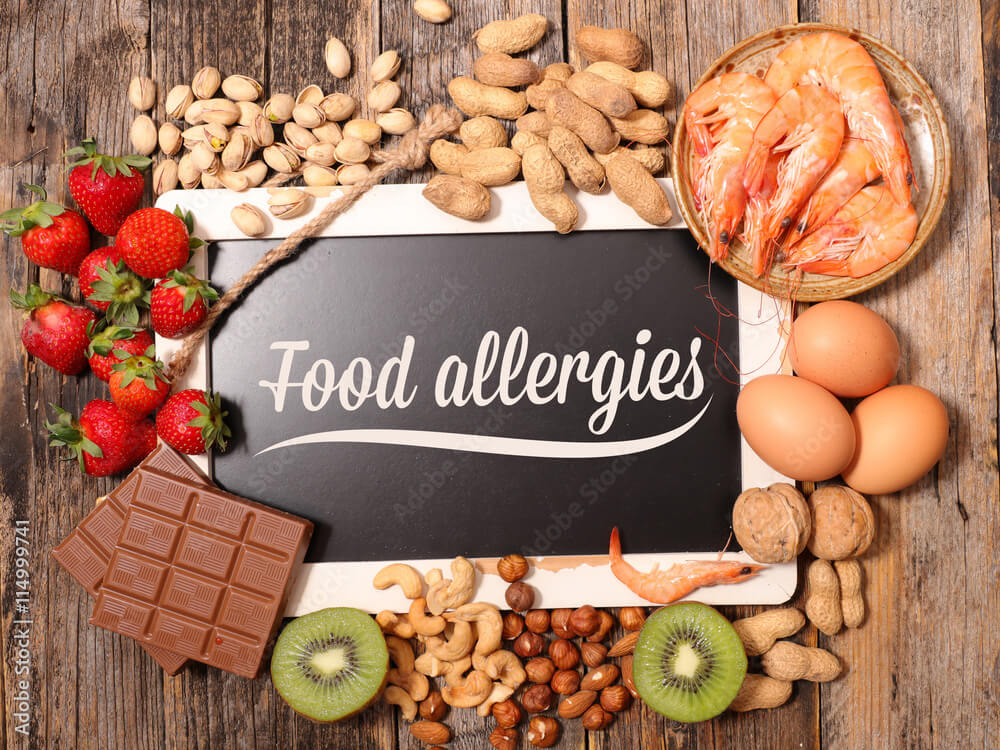 Kid Allergies: Surprising Truths 2 allergy food