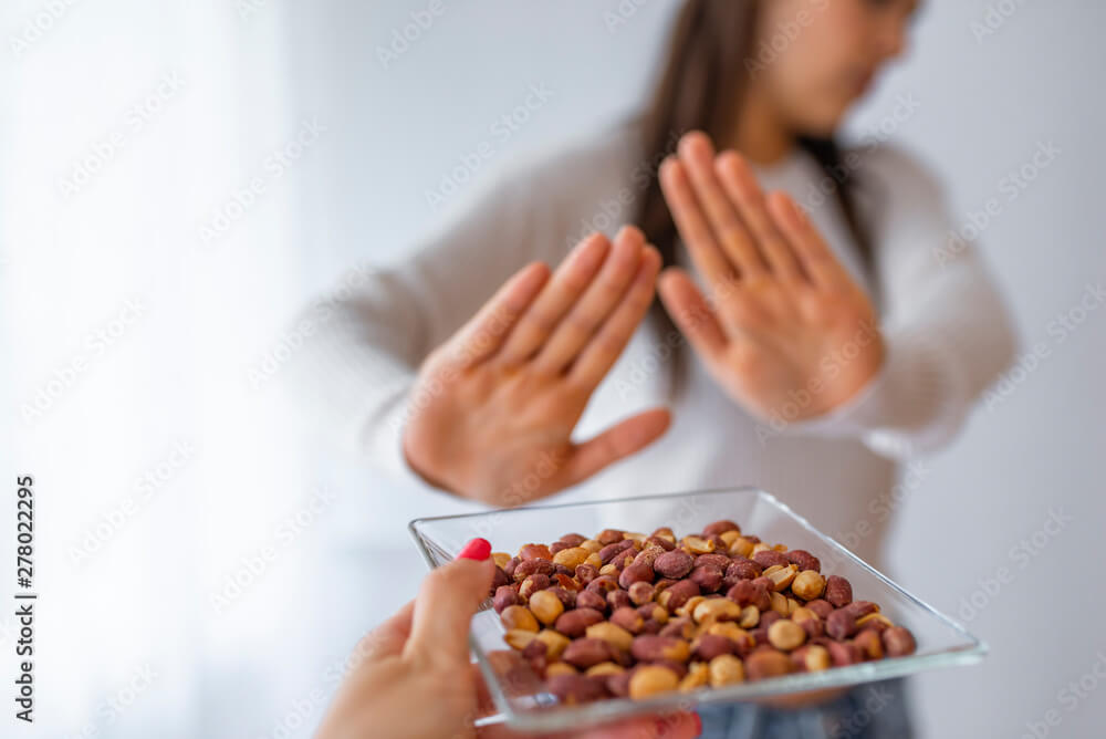 Peanut food allergy concept. Great concept of allergy and skin diseases. Nut allergies. No peanuts.