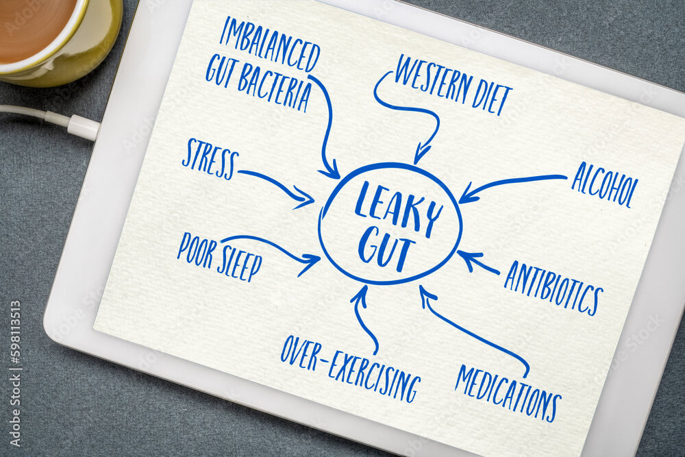 causes of leaky gut syndrome - text and drawing on a digital tablet, digestive health concept